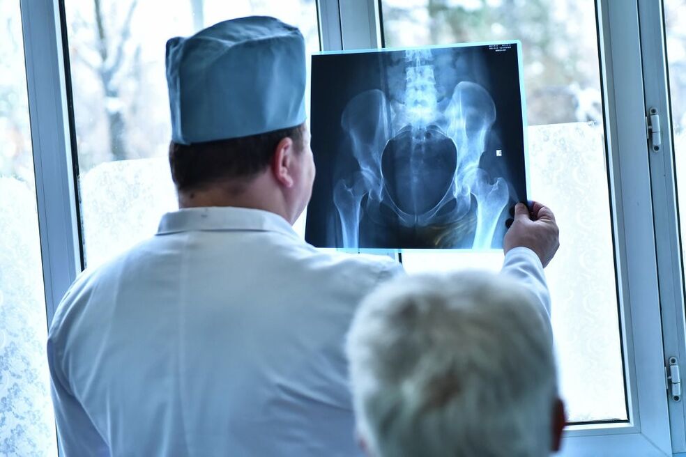 Le médecin examine l’image d’une articulation de la hanche souffrant d’arthrose